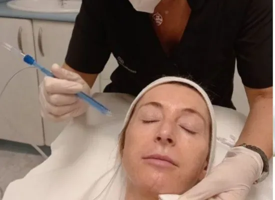 Peeling facial en Ejea